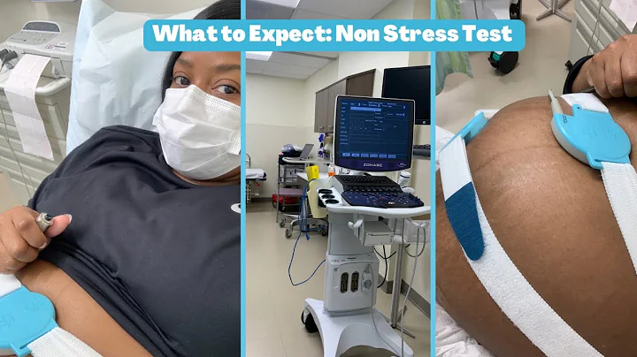 EP. 44: My First Fetal Non Stress Test (What to Ex...