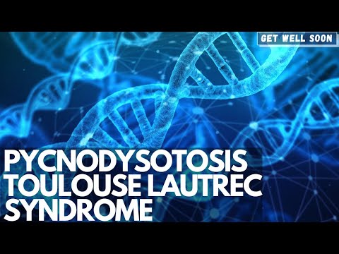 Wideo: Zespół Toulouse-Lautreca (piknodysostoza): Czy Istnieje Lekarstwo?