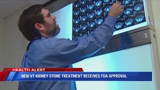 VT researcher develops less painful kidney stone treatment