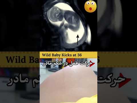 حرکات طفل در شکم مادر      