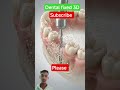 #dental #fixed #human #teeth 🏥💉💊💊💉🏥💉💊💊💉💉💊