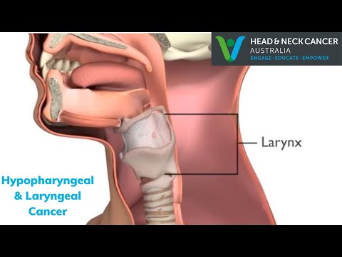 Hypopharyngeal & Laryngeal Cancer - What Is It? What are Symptoms & Treatment? - Head & Neck Cancer