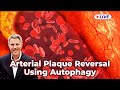 Arterial plaque reversal using autophagy live