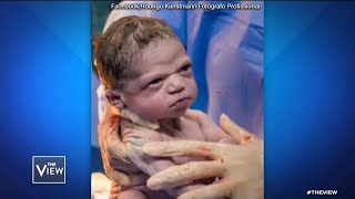 Newborn Baby’s Facial Expression Goes Viral | The View