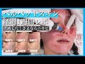 【毛穴撲滅!美容医療】ベルベットスキン施術/経過詳しくレポ！肌が生まれ変わる美肌治療【ダーマペン🖋】