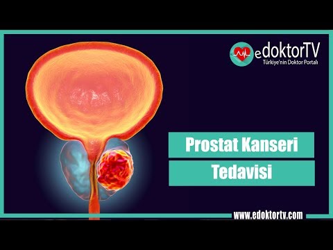 Video: Novel Pendekatan Untuk Mengenal Pasti Biomarker Kanser Prostat Yang Agresif