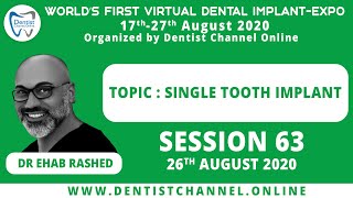 Single Tooth Implant | Dr Ehab Rashed | Session 63 screenshot 1