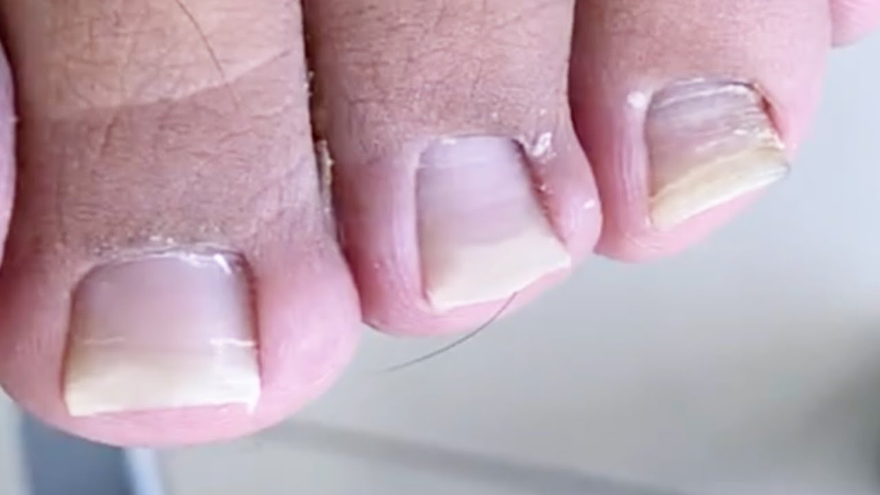 Super easy trim! YouTube