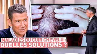 Maladies du cuir chevelu : quelles solutions ?