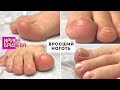 Педикюр 🌸 Вросший ноготь 🌸 Обработка пальцев ног 🌸 Ирина Брилёва