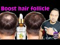 Use Daily Grow Hair Back | HAIR REGROWTH Serum | hair loss cure