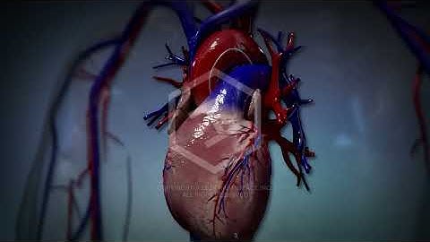 Stent Procedure