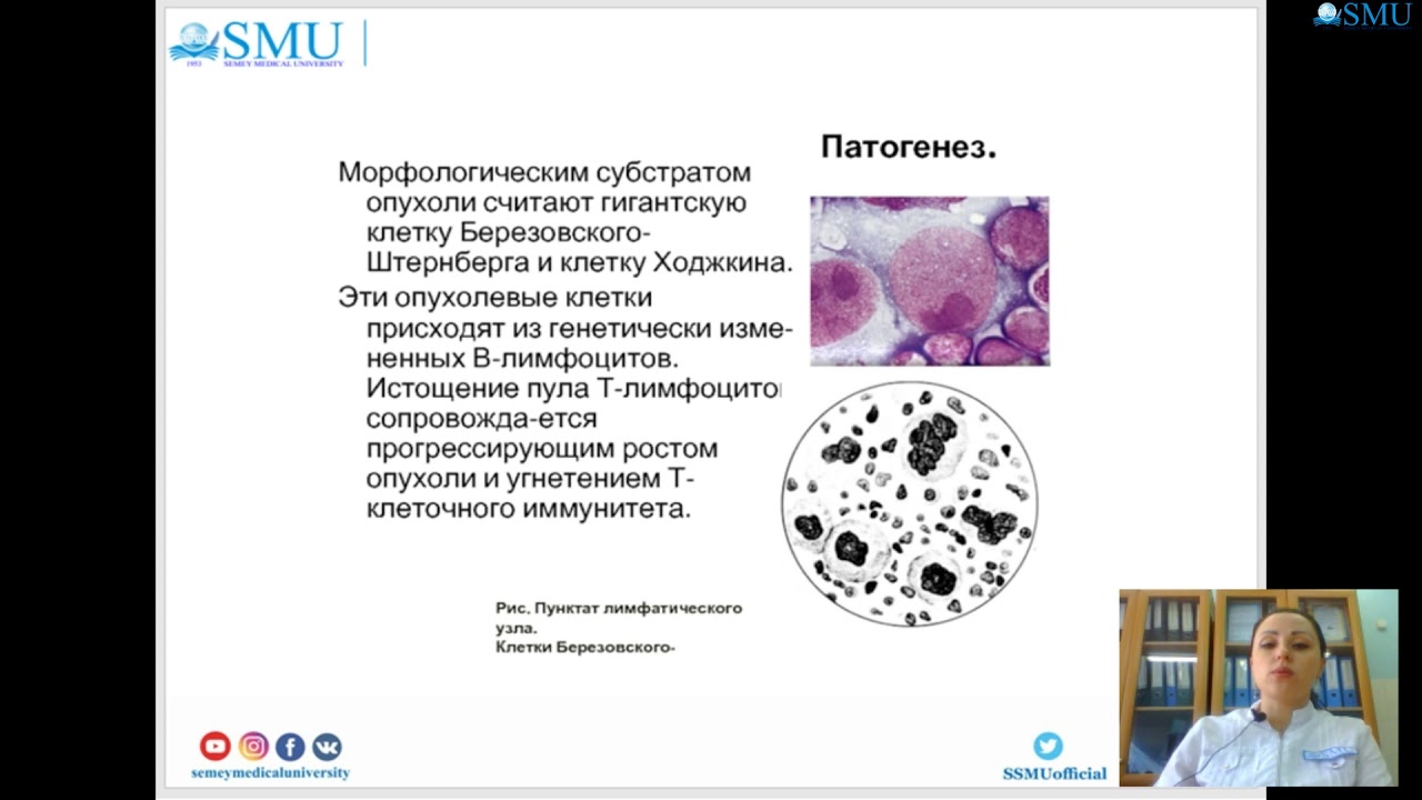 Злокачественные новообразования лимфоидной кроветворной ткани. Опухоли кроветворной ткани. Опухоли из кроветворной и лимфатической ткани. Миелодиспластические состояния.