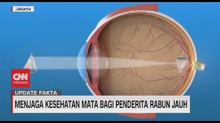 Menjaga Kesehatan Mata Bagi Penderita Rabun Jauh