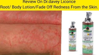 Review On Dr.davey Licorice Root Body Lotionfade Off Redness From The Skin.