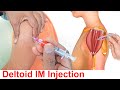 How to give an intramuscular (IM) Injection in deltoid muscle in shoulder easily at home