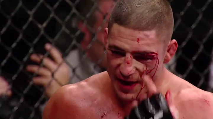 Diego Mad Man Sanchez vs  Shilbert Melendez MMW(Me...