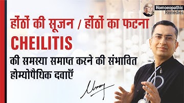 कटे फटे होंठ  || Angular Chelitis || Exfoliative Chelitis || Natural homeopathic remedies & symptoms