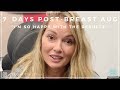 Breast Aug by Dr. Motykie - One Week Patient Testimonial