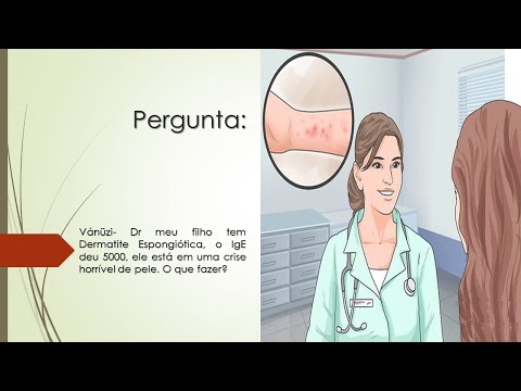 Vídeo: Dermatite Espongiótica: Causas, Sintomas E Tratamento