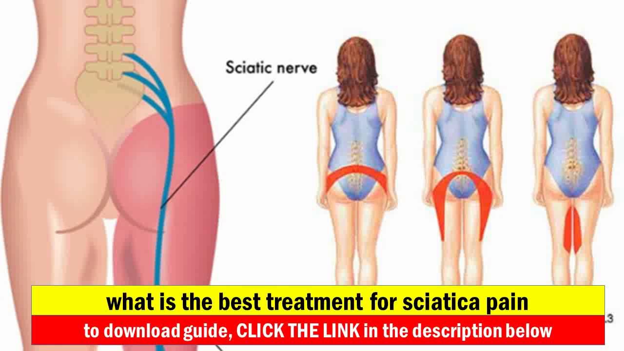 best medication for sciatica nerve pain - best medication ... the muscles around knee diagram 