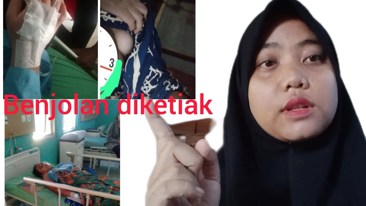 operasi benjolan diketiak pake BPJS||mamae aberans