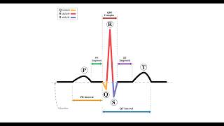 How to Graph an Electrocardiogram (EKG) in Python (Complete Beginner)