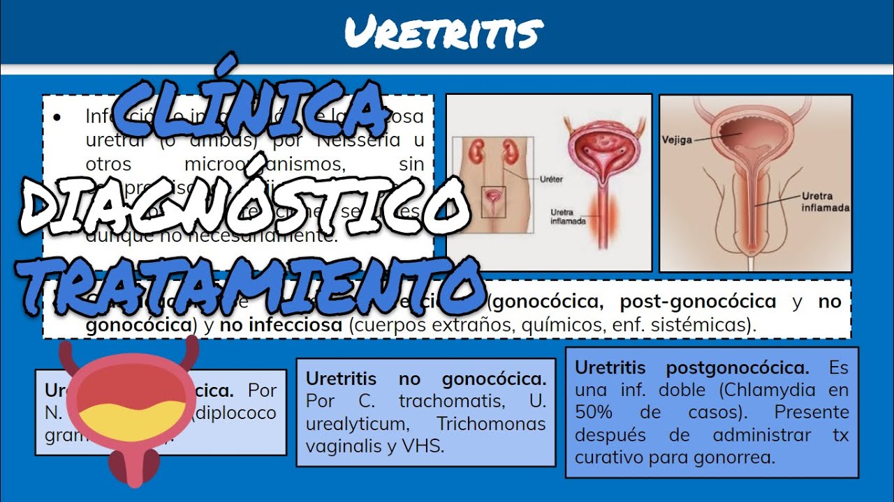 ¿Qué es la uretritis no gonocócica (NGU)? | Guía de salud | Vidaliax