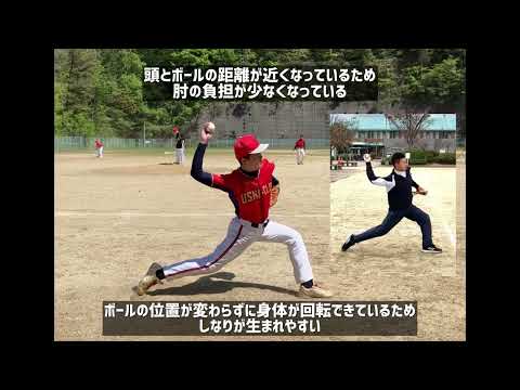 肩・肘の負担を減らすために投球動作をチェックします 少年野球〜プロ野球選手のリハビリを担当する理学療法士が実施