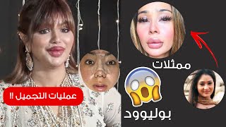 10 ممثلات بوليوود قمن بعمليات تجميل | قبل وبعد