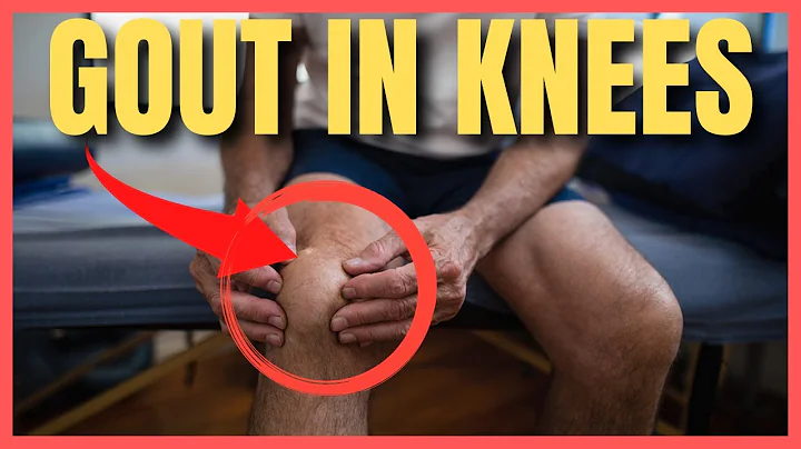 Is Your Knee Pain a Sign of Gout? - DayDayNews