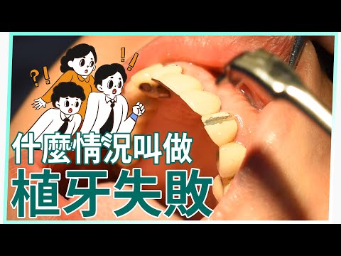 【怕植牙失敗？植牙專業朱裕華醫師來救援！EP.5】什麼樣的情況是植牙失敗呢？植牙就來台中北屯新華牙醫  #植牙推建 #高壓氧艙