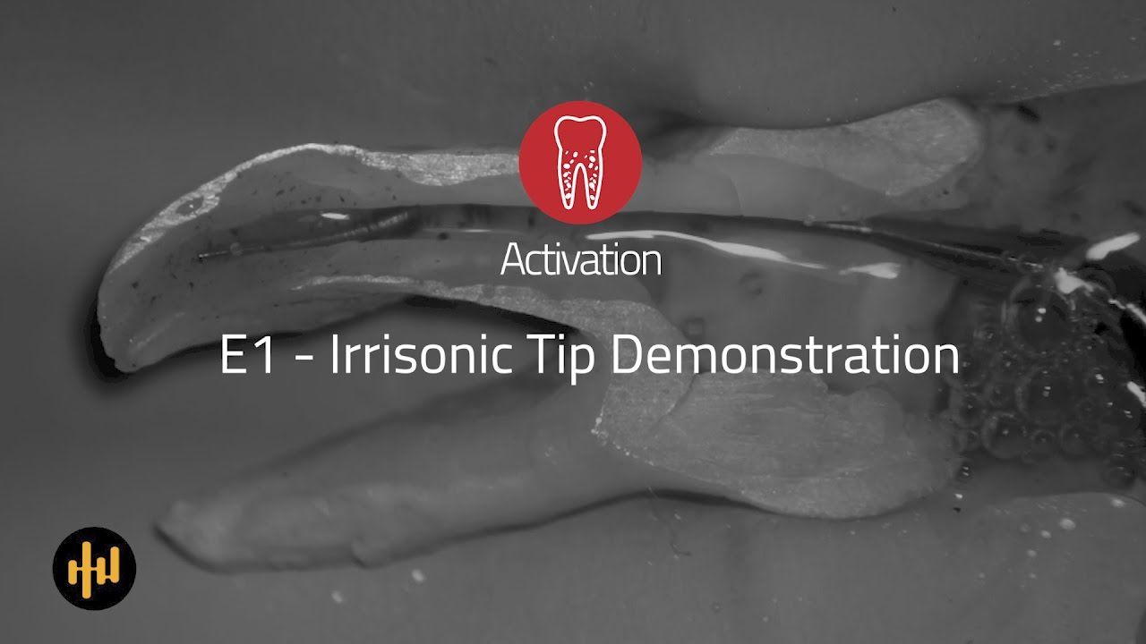 Helse Ultrasonic Endo Activation E1 Irrisonic Tip Demonstration