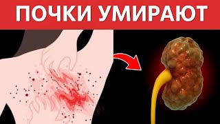 ПРИЗНАКИ ТОГО, ЧТО ВАШИ ПОЧКИ УМИРАЮТ!!!