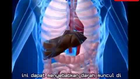 Liver/Hati/Hepatitis/Sakit Kuning