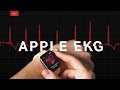 Why doctors are worried about the Apple Watch EKG