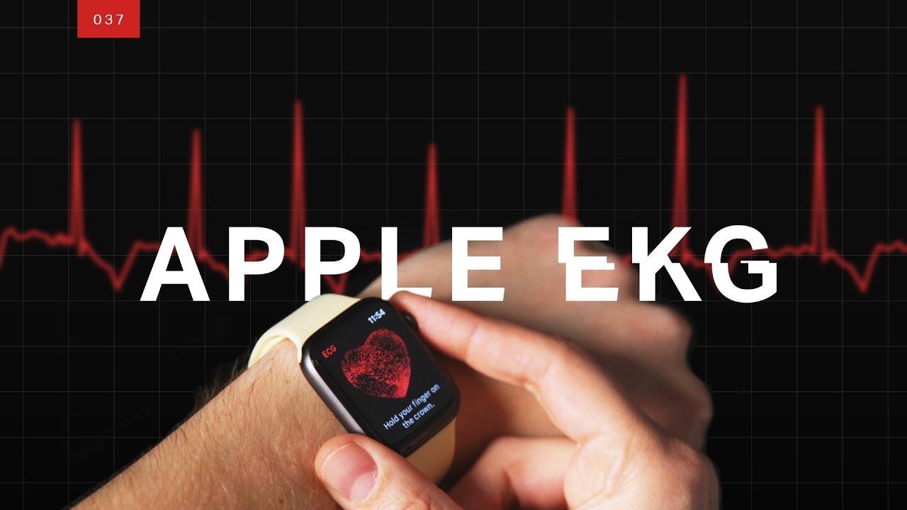 Can A Smartwatch Detect Heart Problems?