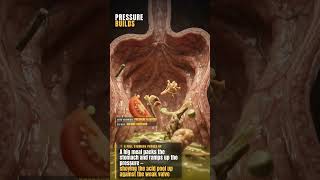 What GERD Actually Looks Like Inside Your Chest (Part 1)