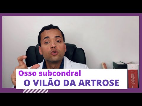 Osso subcondral, um dos vilões da artrose