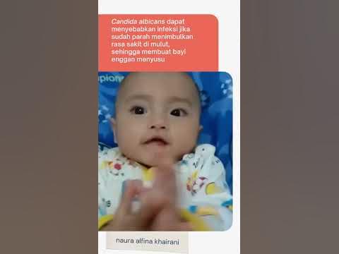 cara mengatasi lidah putih pada bayi #shorts