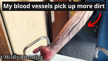 mildly interesting reddit