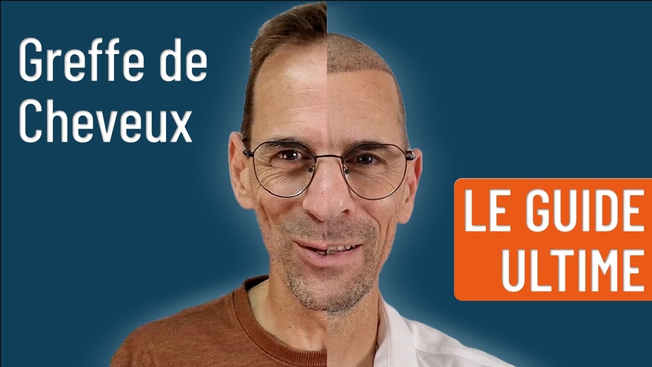 Greffe de Cheveux en Turquie : 26 conseils incontournables pour réussir l'expérience - Estemark