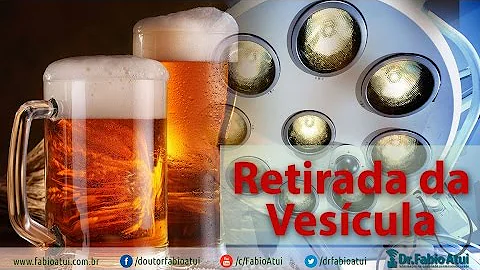 Quanto tempo depois de uma cirurgia posso beber cerveja?