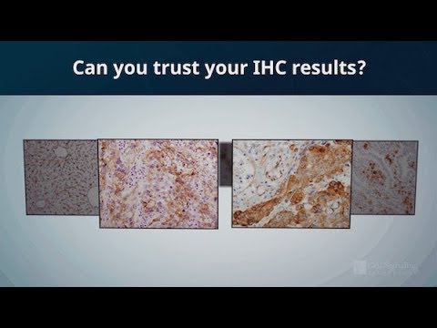 Can you trust your immunohistochemistry (IHC) results? | CST Validation