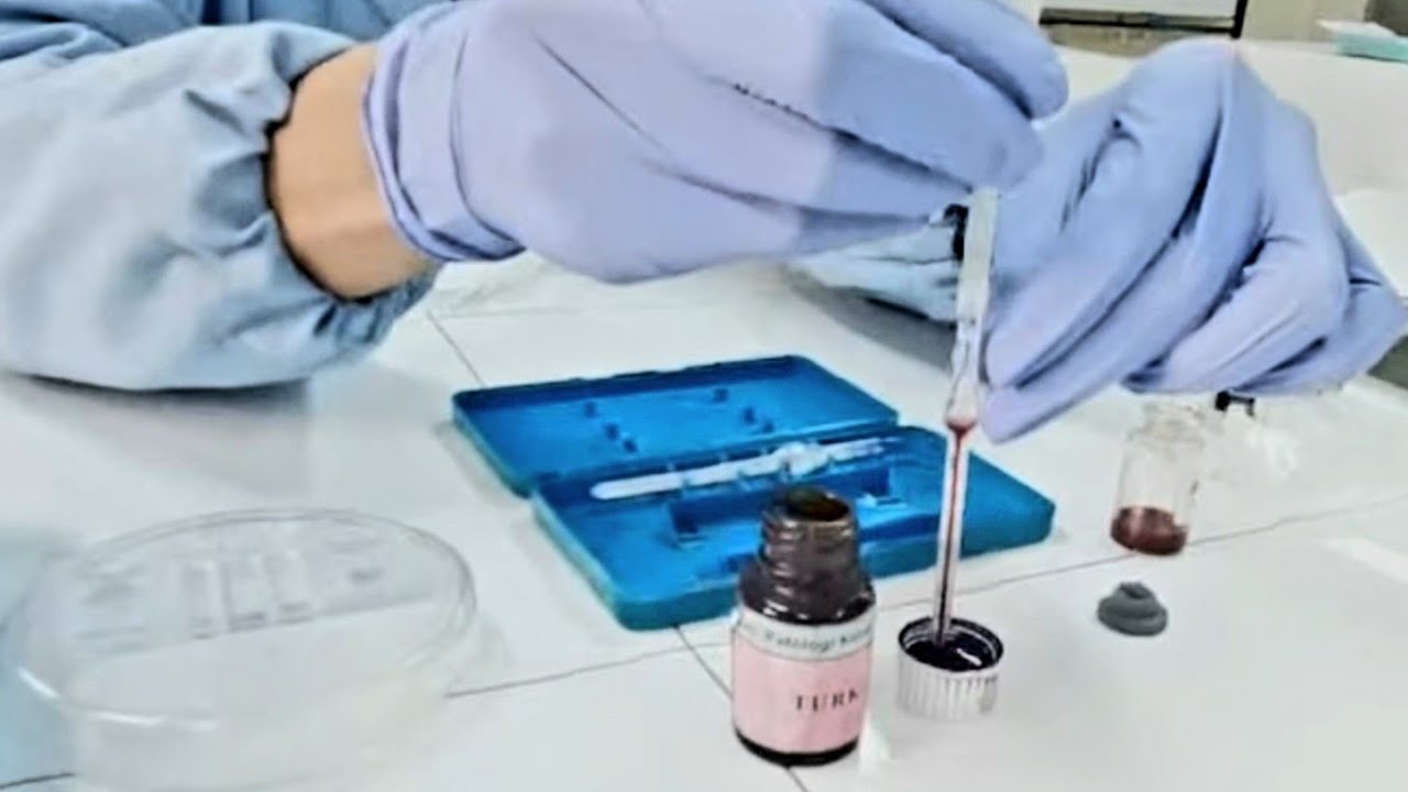 HITUNG JUMLAH LEUKOSIT