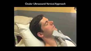 How To: Ocular Ultrasound Part 1 Case Study Video screenshot 1