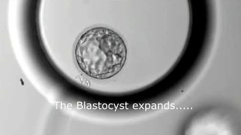 Blastocyst Development - Day 3 to Day 5 (MUST SEE)