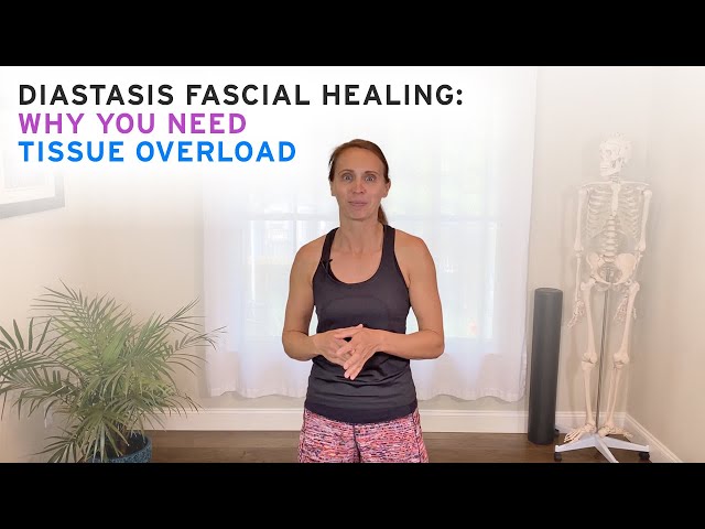 Diastasis Fascial Healing  Why you need Tissue Overload 