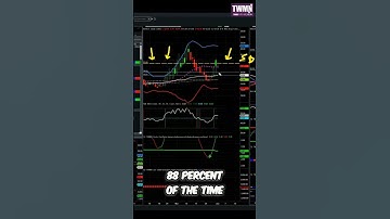What VIX Tells You About Risk #shorts #trading #tradingstrategy