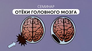 Отёки головного мозга